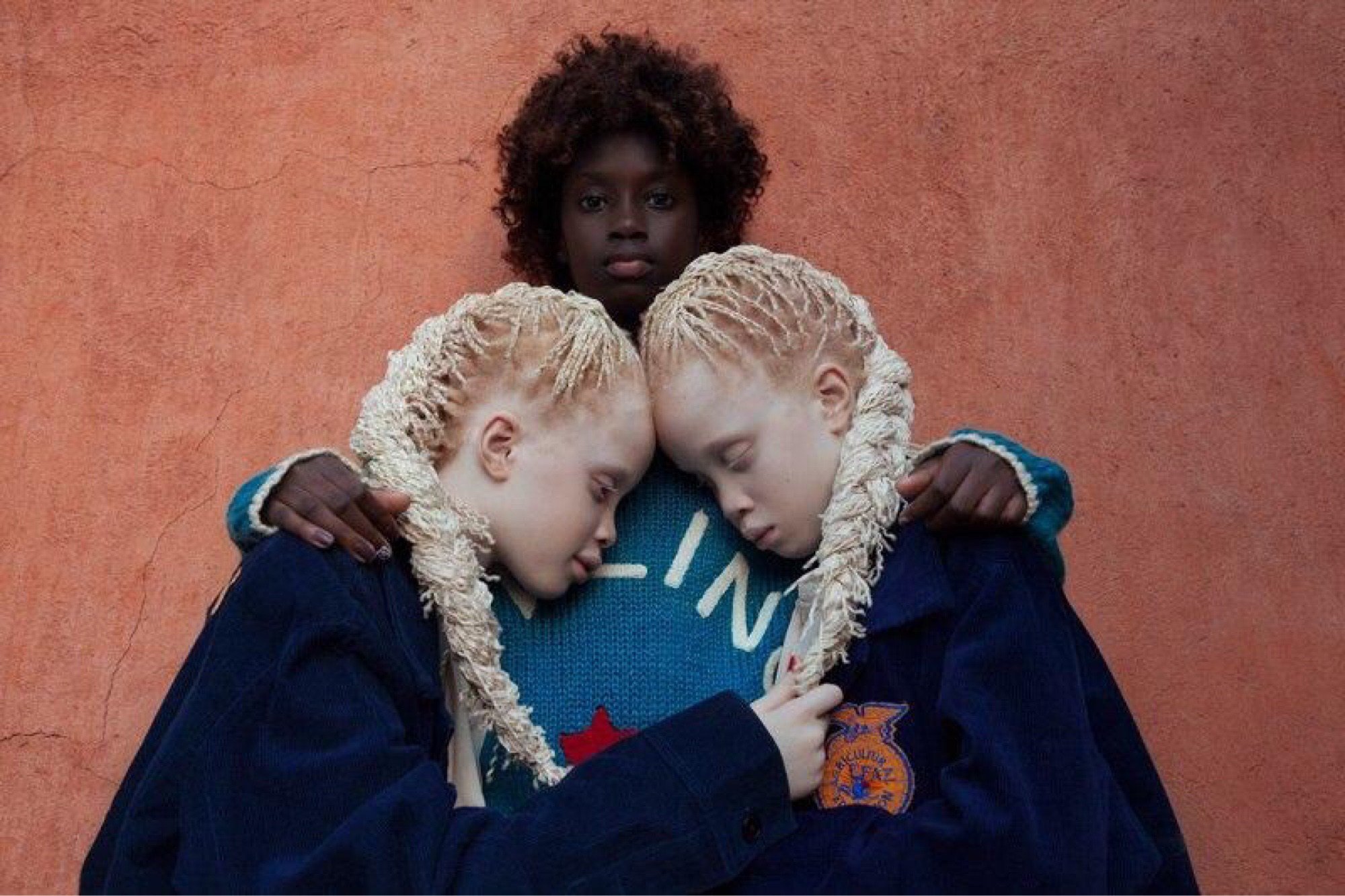 И ее удивительные дети. Сестры альбиносы Бавар.